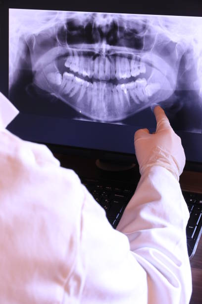 Best Emergency Dentist for Knocked-Out Tooth in Osceola, IA