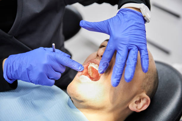 Best Emergency Dentist for Lost Fillings or Crowns in Osceola, IA