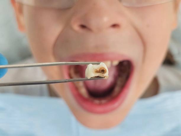 Best Orthodontic Emergency Dentist in Osceola, IA